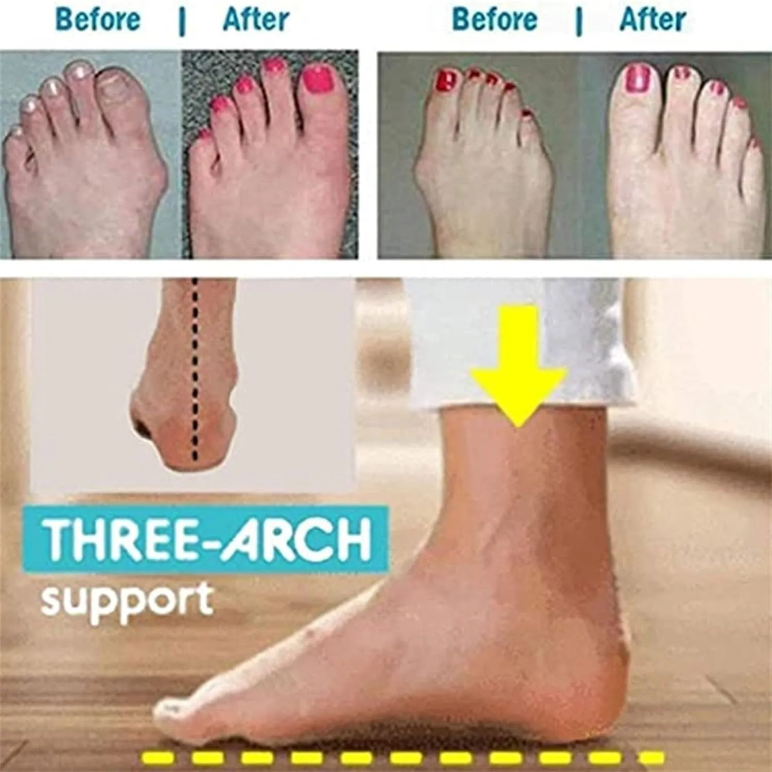 Women's Comfort Flat Sandals, Women Fashion Breathable Clip Toe Bunion Corrector Flat Shoes, Animal Print Crocodile Pattern Beach Travel Sandals, for Bunion Splints Toe Separator