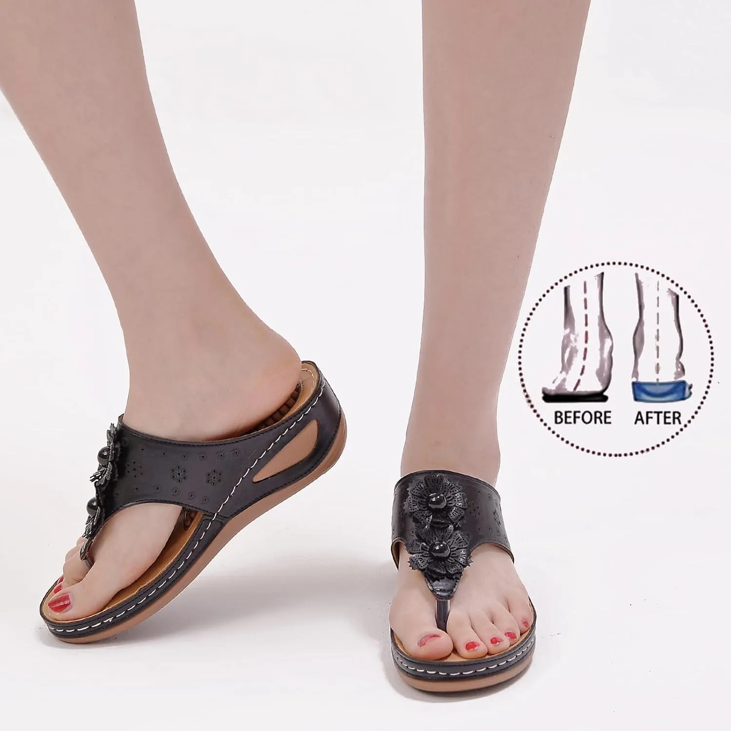 Womens Comfy Wedge Orthopedic Sandals Summer Platform Wedges Flower Comfortable Dressy Casual Beach Shoes Slides Walking Flip Flops for Women with Arch Support Breathable Lightweight Slippers